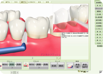 カウンセリングソフト・デンタルフラッシュ
