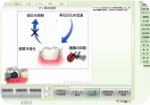 フッ化物塗布画像